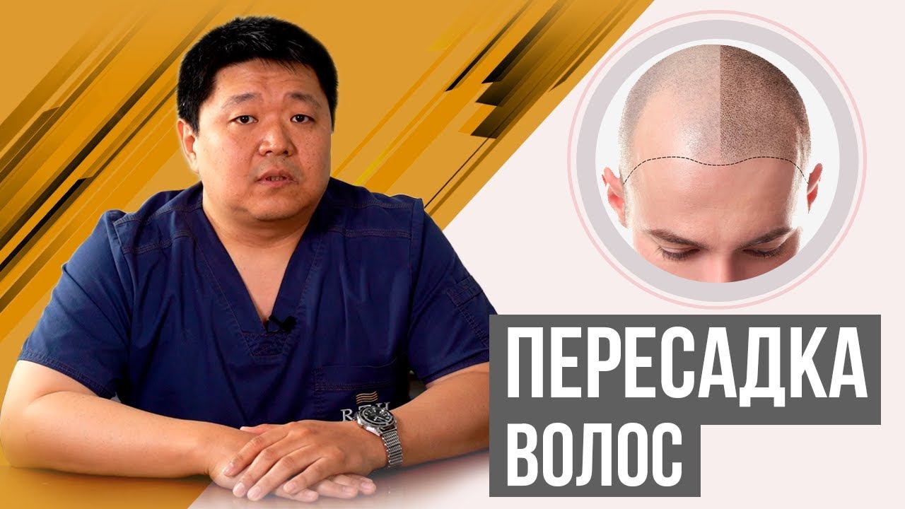Преимущества пересадки волос для мужчин Преимущества пересадки волос для мужчин